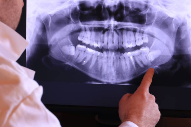 Best Emergency Treatment for Jaw Pain or Injury in East Orange, NJ